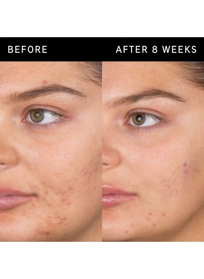 The INKEY List Salicylic Acid Cleanser 150ml - Image 4